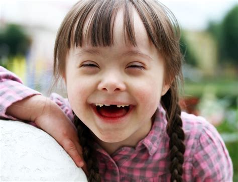 Why Dawkins Is Wrong About People With Down S Syndrome Life Free Nude