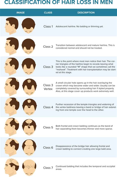 Hair Transplant Growth Chart Hot Sex Picture