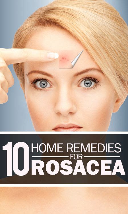 How To Treat Acne Rosacea Languagede Weg Mit Roten Äderchen Mit