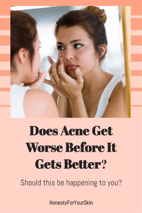 Acne Getting Worse Before It Gets Better Should It Be