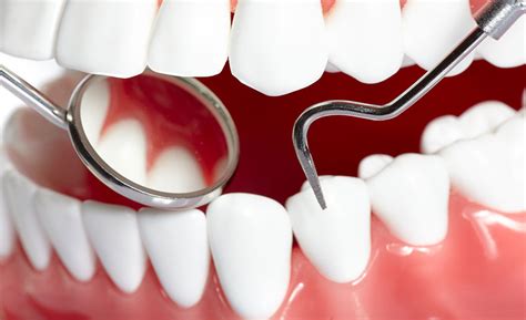 Parodontologia Dental Cui