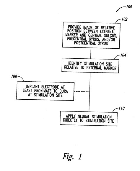 Patent Us20110208263 System And Method For Treating Parkinsons