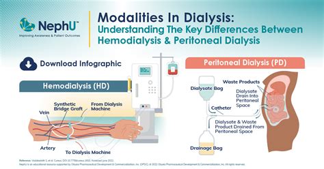 Infographic Modalities In Dialysis Understanding The Key Differences