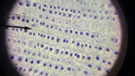 We did not find results for: Mitosis in Onion Root Tips - YouTube