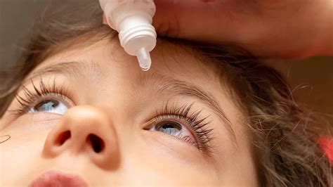 Best Allergy Eye Drops For Kids Fox31 Denver