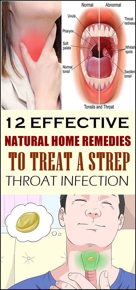 12 effective natural home remedies to treat a strep throat infection throat infection strep