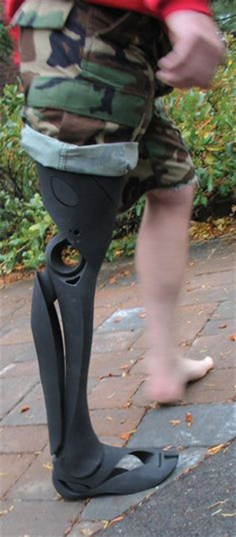 1000 Images About Prothesen Prosthetics On Pinterest Prosthetic