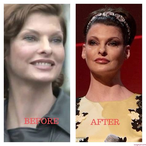 Linda Evangelista Before And After Photos