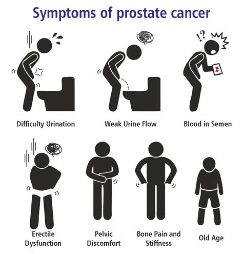 Prostate Cancer Symptoms Treatment And Diagnosis