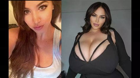 OnlyFans Model S Breasts Grow Cup Sizes In Months Due To Rare