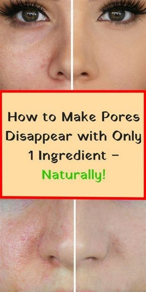 How To Get Rid Of Large Pores Remedies To Minimize Pores On Face