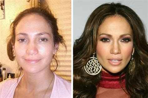 Gone are the days when you could spot somebody who had plastic surgery procedures with ease. Celebrity Plastic Surgery Before & After (56 pics ...