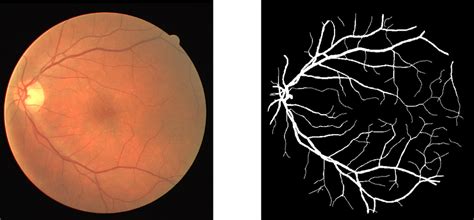 Representative Fundus Image Right From The Drive Image Database And