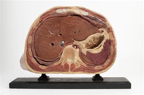 Steger His Model Of Transverse Section Thoracic Dissection Faculty Of