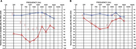 Frontiers Changes In Auditory Perceptions And Cortex Resulting From