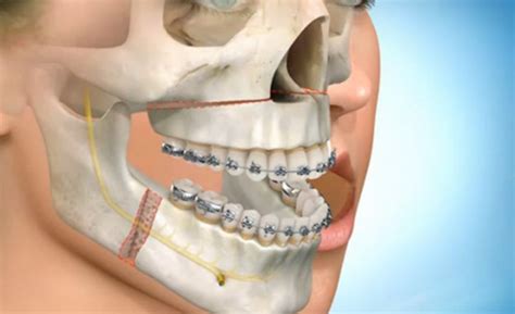 Simple Science: How to Make a Volcano with Kids