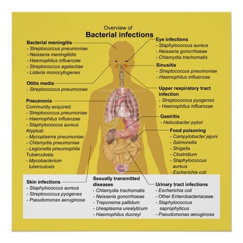Overview Of Bacterial Infections Poster Zazzle Bacterial Infection
