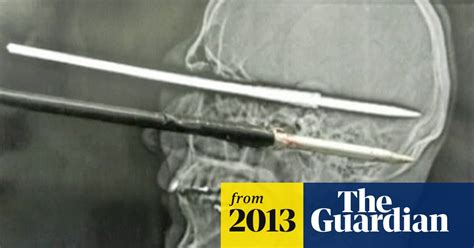 Man Survives After Shooting Himself In Head With Harpoon Video World News The Guardian