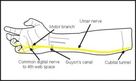 Ulnar Nerve Lesions Uk Ulnar Nerve Hand