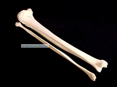 Antique Real Human Leg Bones Authentic Anatomical Model For Medical Study B