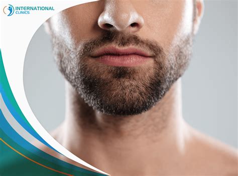 Beard Transplant In Turkey Great Advantages Low Costs