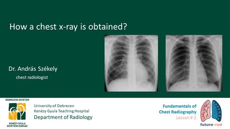 Fundamentals Of Chest Radiography Lesson 2 Youtube