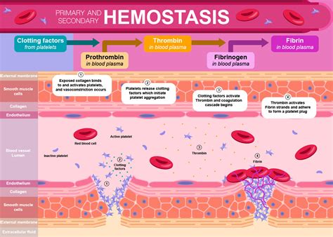 Sangrado Y Coagulacion De La Sangre Hemostasia Y Proceso Hemostatico Images