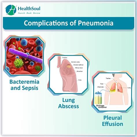 Pneumonia Symptoms And Treatment Healthsoul
