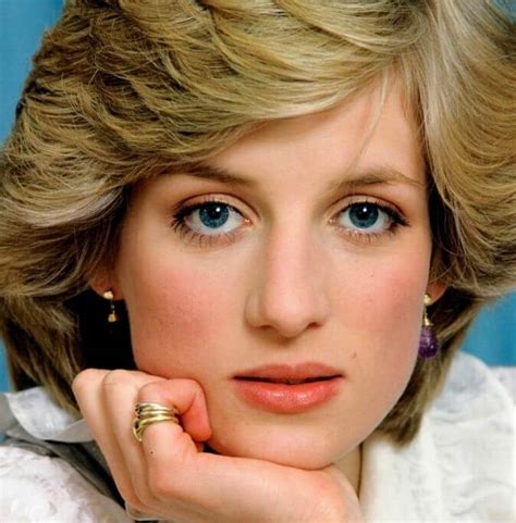 Even Princesses Have Rosacea How Lady Diana Managed Her Disorder
