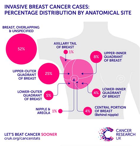 Breast cancer information > facts & statistics > breast cancer statistics. Cancer of the breast: statistics | MORE IN CANCER A-Z