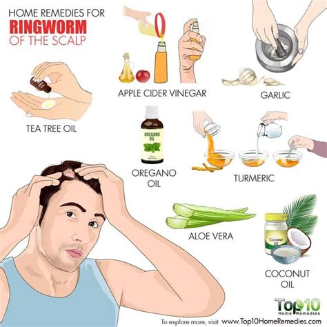 7 Home Remedies To Fight Ringworm Of The Scalp Top 10 Home Remedies