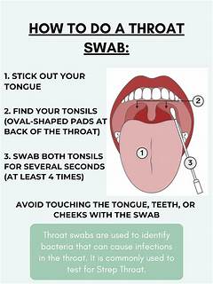 Test For Strep Throat Minute Clinichtimeline Photos
