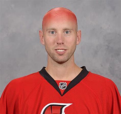 How The Sens Can Have The Perfect Summer Bonks Mullet