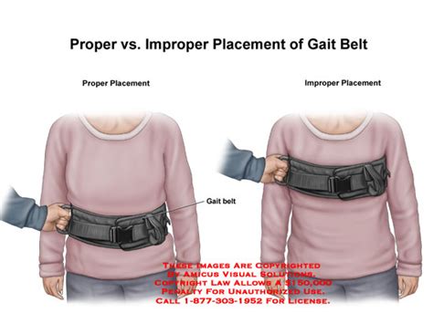 Placement Of Gait Belt