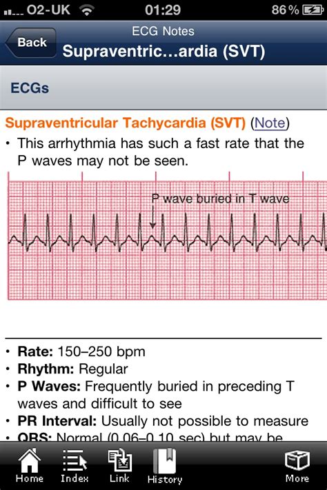 Ecg Notes Highly Detailed Ecg Reference Guide