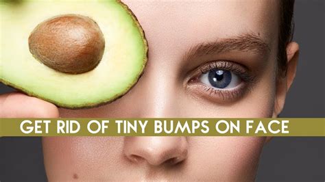 Get Rid Of Tiny Bumps On Face Simple Home Remedy How To Get Rid Of