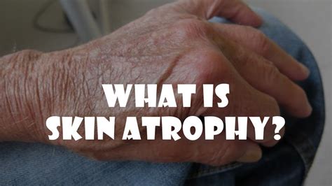 Atrophy Skin