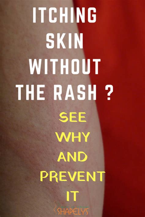 Causes And Therapies For Itchy Skin Without A Rash Itching Skin Dry