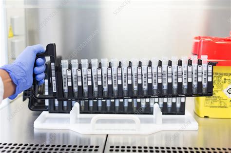 Le test pcr est aujourd'hui remboursé à 100% par. Loading of the reagents of COVID-19 screening PCR test - Stock Image - C050/6110 - Science Photo ...