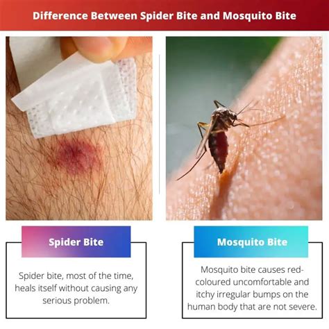 Spider Bite Vs Mosquito Bite Difference And Comparison