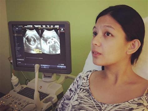 Jennica garcia welcomed her second child with alwyn uytingco on monday. LOOK: Jennica Garcia, Alwyn Uytingco share sonogram of ...