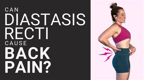 Can Diastasis Recti Cause Back Pain Get Mom Strong