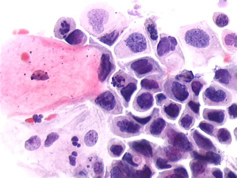 Cytopathology Of The Uterine Cervix Digital Atlas
