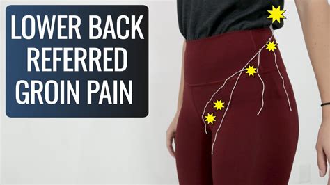 Can Low Back Pain Cause Groin Pain Yes Heres How Youtube