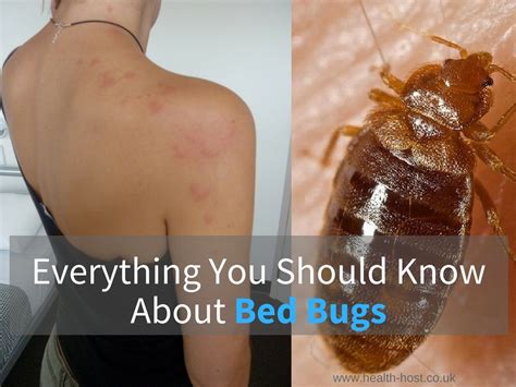 How itchy are bed bug bites? Bed Bugs 101 - How Long do Bed Bug Bites Last ? - All You ...