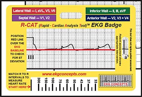 Top 10 Ekg Quick Reference Card For 2019