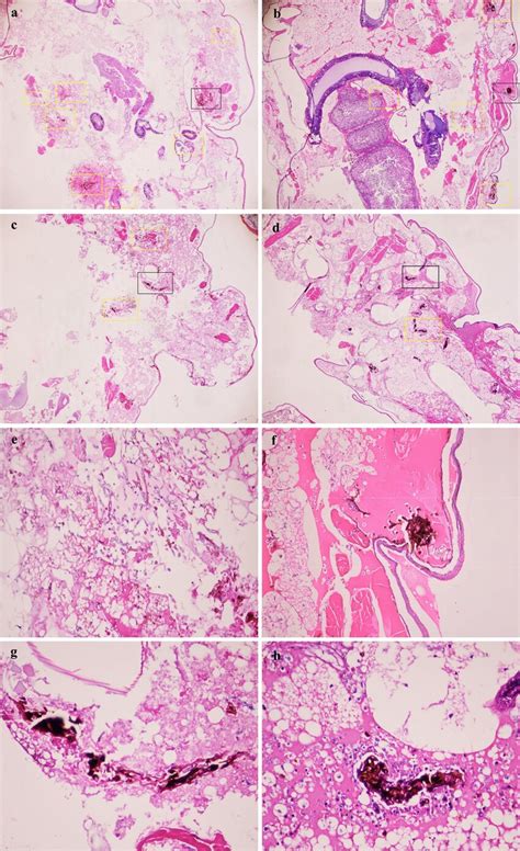Histopathological Analysis Of Infected G Mellonella Following Download Scientific Diagram
