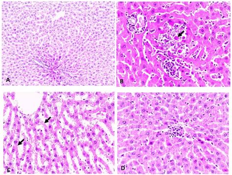 Hematoxylin And Eosin Hande Staining Of Liver Tissue A Control