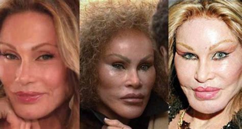 Hollywood Celebrities Who Have Spent Thousands On Cosmetic Surgery