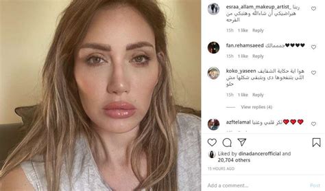 ريهام سعيد تتعرض لحادث سير خطير سيارة ريهام سعيد بعد الحادث ويذكر ان ريهام سعيد قد عانت العام الماضي من عدة أزمات كبيرة كادت ان تودي بها إلى. ريهام سعيد تثير الجدل بشفاه منتفخة.. وتتلقى انتقادات الجمهور